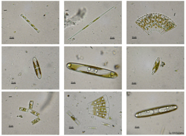 Figure 4: Freshwater diatoms. From Wikimedia Commons